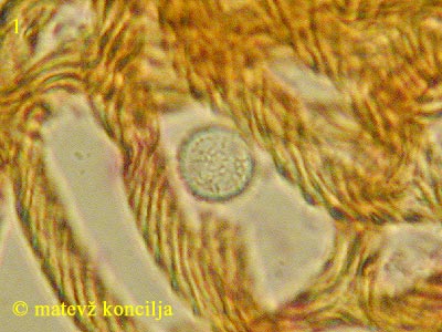 Hemitrichia calyculata - Spore