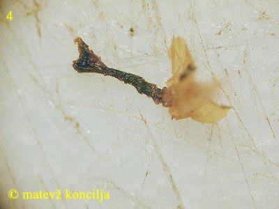 Hemitrichia calyculata - Stiel
