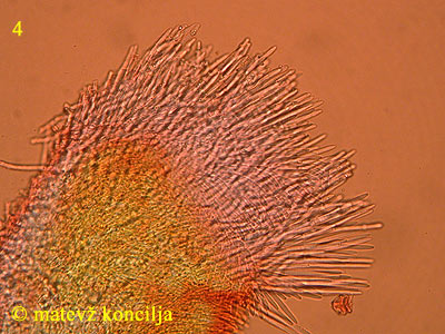 Capitotricha bicolor - Haare