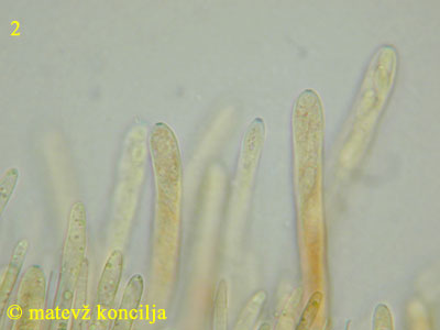 Neodasyscypha cerina - Asci