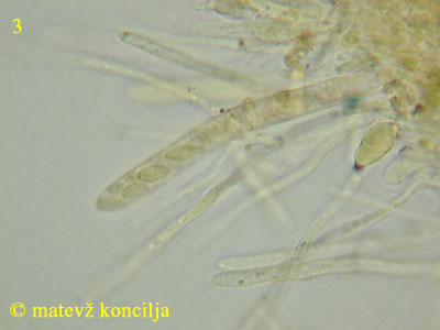Neodasyscypha cerina - Ascus