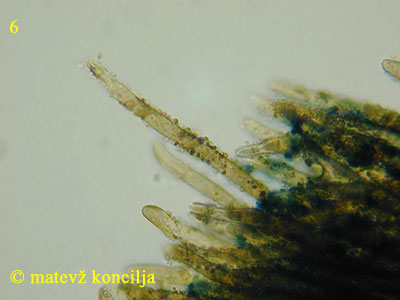 Neodasyscypha cerina - Haare