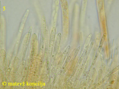 Neodasyscypha cerina - Paraphysen