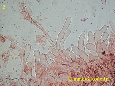 inocybe cervicolor - kajlocistide