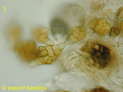 Phragmotrichum chailletii - Konidien