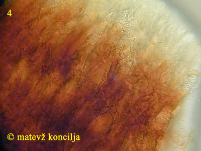 peniophora cinerea - lamprocistide