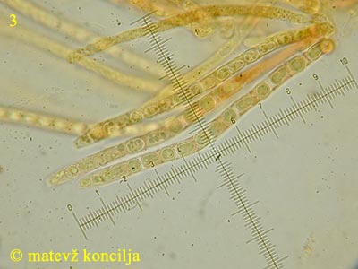 Trichoderma citrinum - Asci