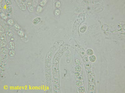 Trichoderma citrinum - Ascusbasis