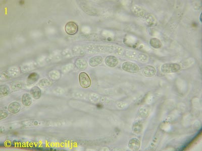Trichoderma citrinum - Sporen