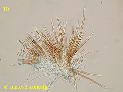Lasiobelonium variegatum - Haare