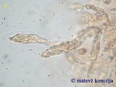 Thyronectria coryli - Ascus mit Ascosporen