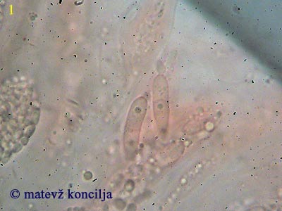 Thyronectria coryli - Ascosporen