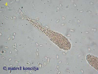 Thyronectria coryli - Ascus mit Ascokonidien