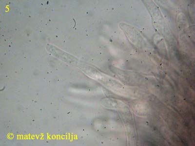 Dumontinia tuberosa - Excipulumhaare