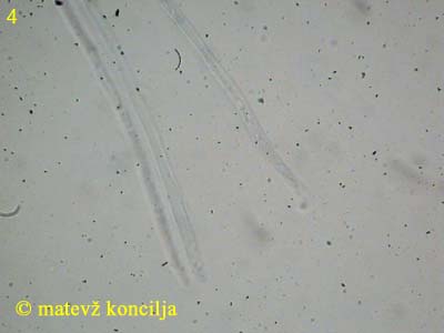 Dumontinia tuberosa - Paraphysen