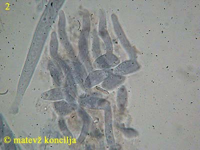 Dumontinia tuberosa - Sporen