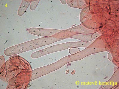 coprinellus disseminatus - pileocistide