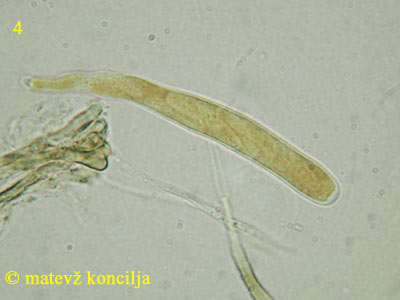 Encoelia fascicularis - Ascus