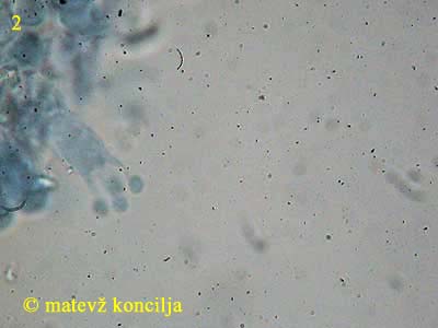athelia epiphylla agg. - bazidij