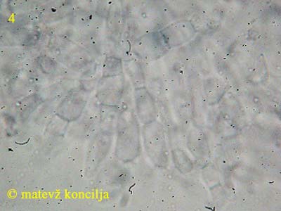 Dialonectria episphaeria - Paraphysen
