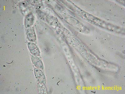 Dialonectria episphaeria - Sporen