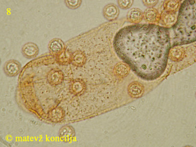 Lycogala flavofuscum - pseudocapillitium