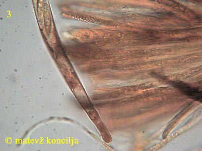 Hymenoscyphus fructigenus - ask