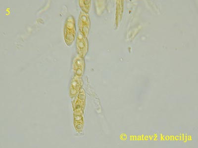 Nectria fuckeliana - Ascus