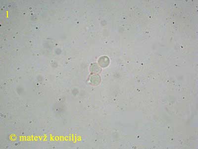 Limacella glioderma - Sporen