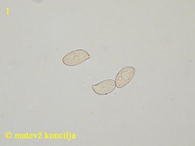 Volvariella gloiocephala - trosi