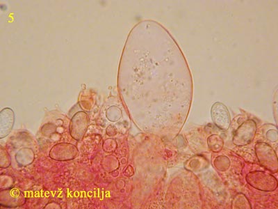 Volvariella gloiocephala - cistide