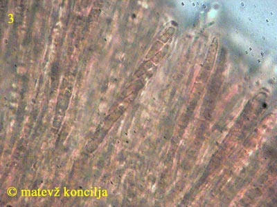 Calycina herbarum - Asci
