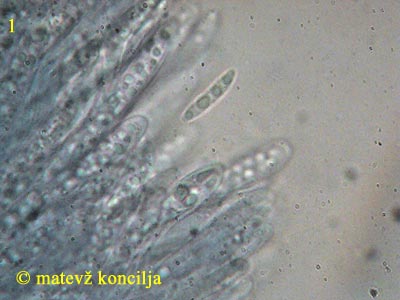 Calycina herbarum - Asci mit Ascosporen