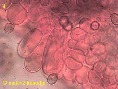 Cortinarius hinnuleus - Marginalzellen