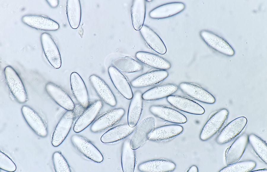 Lasiobolus macrotrichus
