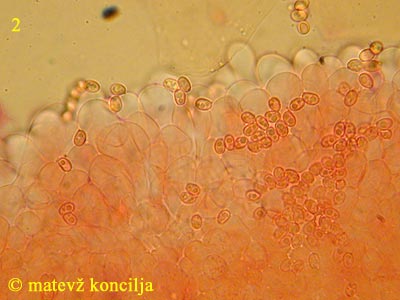 Lepiota lilacea - Zystiden und Sporen
