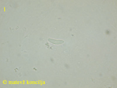 Mollisia lividofusca - Spore