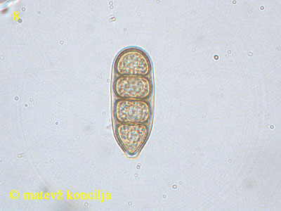 Macrodiplodiopsis desmazieresii