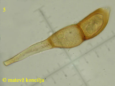 Puccinia magnusiana - Teliospore