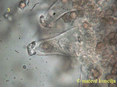 inocybe-margaritispora-Cheilozystiden