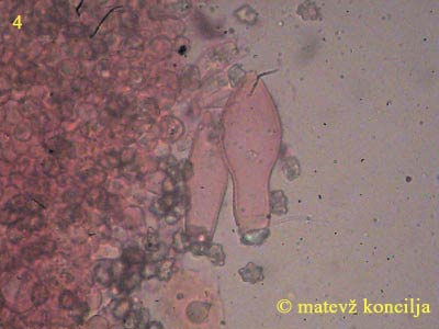 inocybe-margaritispora-Cheilozystiden