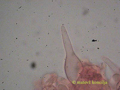Melanoleuca cognata - kajlocistide