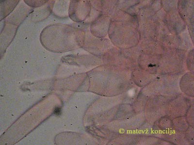 Melanoleuca cognata - kajlocistide