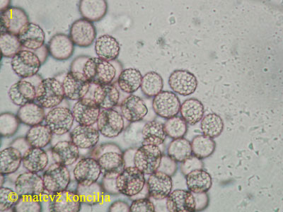 Microbotryum violaceum - Sporen
