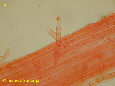 Psathyrella microrhiza - Kaulozystiden