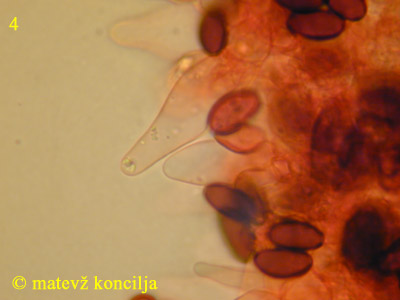 Psathyrella microrhiza - Cheilozystiden