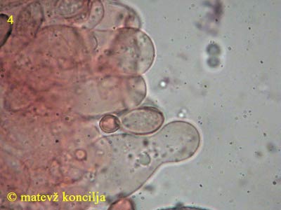 Agrocybe dura - Cheilozystiden