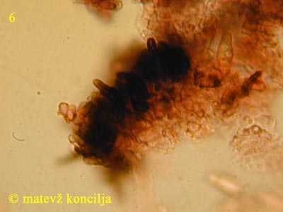 Capronia nigerrima - Setae