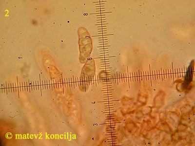 Capronia nigerrima - Sporen