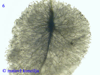 Comatricha nigra - capillitium